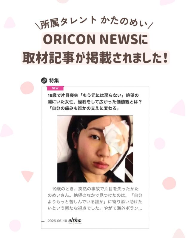 かたのめいの取材記事が「ORICON ニュース」から公開されました！

同時にYahooニュースやLINEニュースでもトップニュースとして公開され大変反響をいただいております！

怪我をした当時の気持ち、歌にかける想い、パーソナルな部分まで公開されております。

ぜひチェックしてみてくださいね！
（記事は弊社ホームページの新着記事からご覧いただけます）

.
.

#かたのめい #視覚障害 #眼球破裂 #ダイバーシティカフェ #シンガー  #眼帯 #障がい #eyepatch #ココダイバーシティエンターテイメント #ここでぐらむ